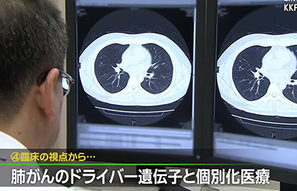 肺がんのドライバー遺伝子と個別化医療